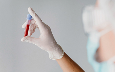 Анализ крови — общий и биохимия - клиника Квинмед